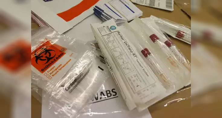COVID-19: Rapid testing kit price fixed at Rs 400 by Delhi HC