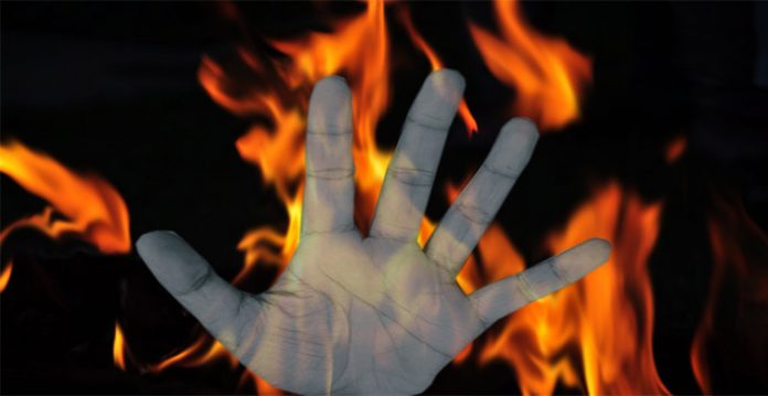 up man set on fire, blames ex girlfriend