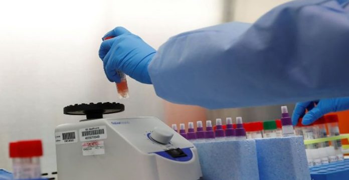 oxford starts human trials of ebola vaccine