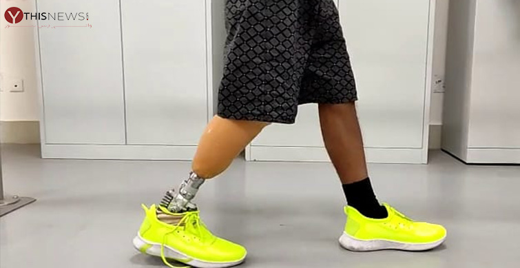 prosthetic leg
