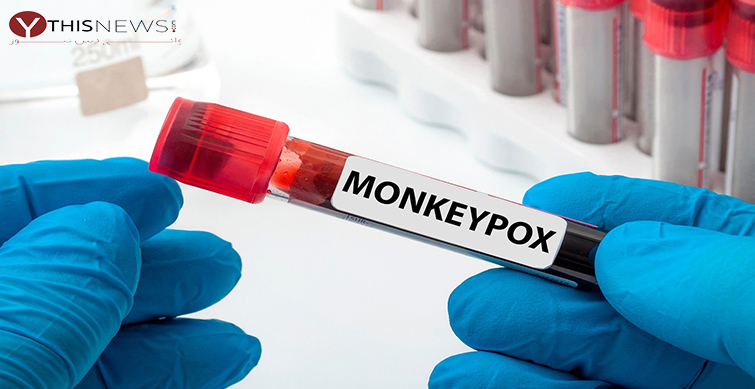 monkeypox