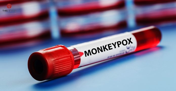 health ministry confirms 1st monkeypox case in delhi, patient isolated