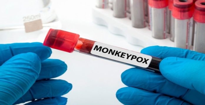asymptomatic infection concerning in monkeypox outbreak study