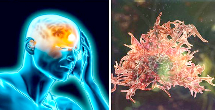 brain eating