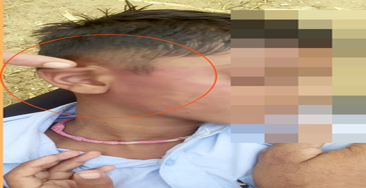 student beaten