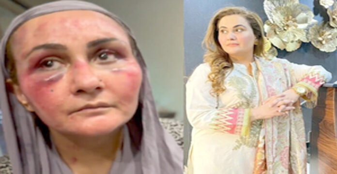 ghazala idrees