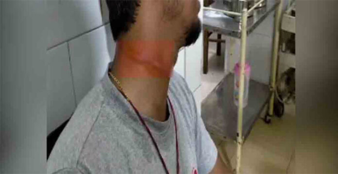 manja accident
